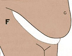 This will keep you dry and stop any rashes (so they say). Courtesy of Amazon